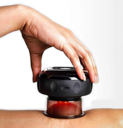 EasyCupping™️ Smart Cupping Device